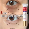 Kem Dưỡng Mắt Nhật Bản Chống Lão Hóa, Nhăn, Bọng Mắt - Giảm Giá 99.000đ