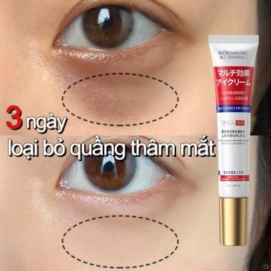 Kem Dưỡng Mắt Nhật Bản Chống Lão Hóa, Nhăn, Bọng Mắt - Giảm Giá 99.000đ