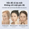 Kem Dưỡng Mắt Nhật Bản Chống Lão Hóa, Nhăn, Bọng Mắt - Giảm Giá 99.000đ 2