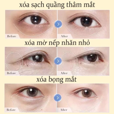 Kem Dưỡng Mắt Nhật Bản Chống Lão Hóa, Nhăn, Bọng Mắt - Giảm Giá 99.000đ 6 Kem Dưỡng Mắt Nhật Bản Chống Lão Hóa, Nhăn, Bọng Mắt - Giảm Giá 99.000đ 6