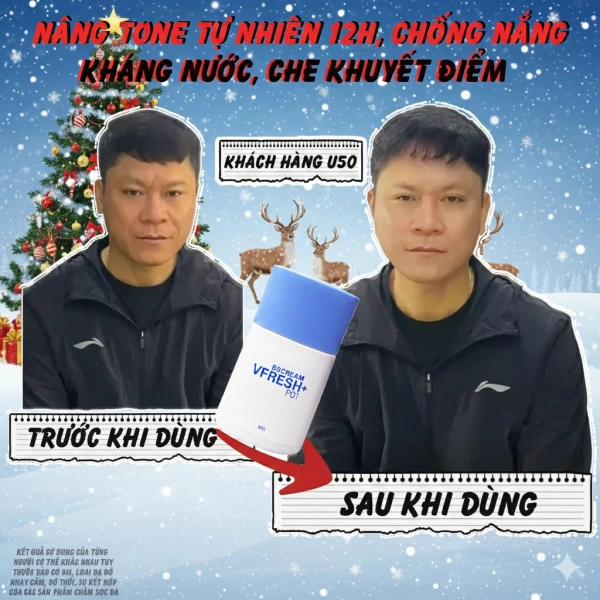 Hình ảnh sản phẩm Kem nền nam V-FRESH PLUS: Nâng tone, kiềm dầu, che khuyết điểm, cấp ẩm, trẻ hóa da, kháng nước