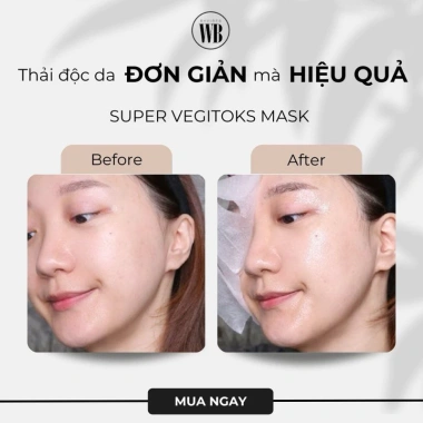 Mặt Nạ Thải Độc Rau Củ BYVIBES Super Vegitoks 25ml - Giá chỉ 13.900 VND