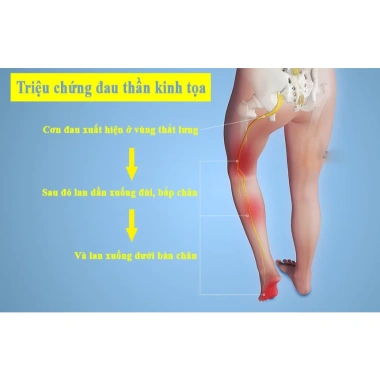 Trà Xương Khớp Bội Lan Đường 50 lọc - Hỗ trợ khớp, giảm đau, Giá ưu đãi 176.000 VND