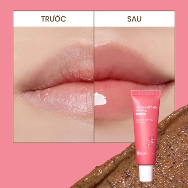 Bộ chăm sóc môi giảm thâm, dưỡng mềm hồng 3 món: tẩy da chết, son dưỡng, mặt nạ ngủ - chỉ 435.000₫