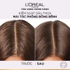 Bộ đôi Gội Dầu Xả Elseve HA 72H + L'Oreal Pure 620ml/375ml – Bồng tóc, Giá 493k 7