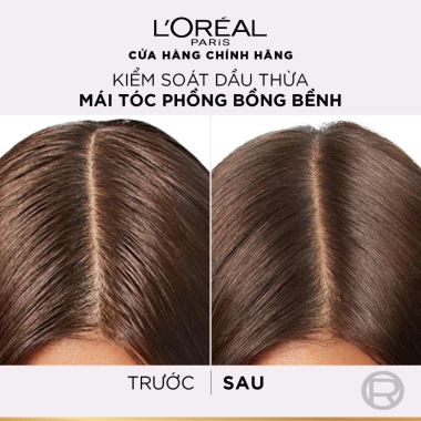 Bộ đôi Gội Dầu Xả Elseve HA 72H + L'Oreal Pure 620ml/375ml – Bồng tóc, Giá 493k 7 Bộ đôi Gội Dầu Xả Elseve HA 72H + L'Oreal Pure 620ml/375ml – Bồng tóc, Giá 493k 7