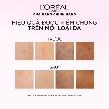 Bộ đôi Peel sáng da L'Oréal Paris Glycolic‑Bright 25ml – Giảm giá 799.000đ, loại bỏ tế bào chết, giảm đốm nâu 5 Bộ đôi Peel sáng da L'Oréal Paris Glycolic‑Bright 25ml – Giảm giá 799.000đ, loại bỏ tế bào chết, giảm đốm nâu 5