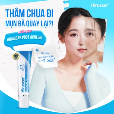 Bộ Gel Hiruscar Post Acne 5g - Giảm mụn 24h, mờ sẹo thâm, chỉ 347k 4 Bộ Gel Hiruscar Post Acne 5g - Giảm mụn 24h, mờ sẹo thâm, chỉ 347k 4