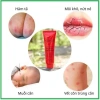 Bùng nổ nâng cấp Kem đu đủ đa năng Úc Lucas Papaw Ointment 25/75gr - Giá 129.999 VND 3