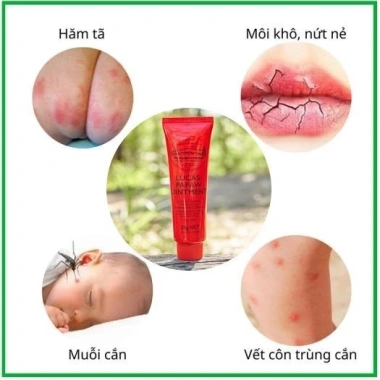 Bùng nổ nâng cấp Kem đu đủ đa năng Úc Lucas Papaw Ointment 25/75gr - Giá 129.999 VND
