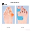 Bunion Corrector 20 Cái - Giảm Đau Băng Thể Thao Bunions & Turf Toe, Miếng Đệm Ngón Chân Lớn, Băng Duỗi Giá 66.000₫ 2