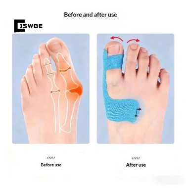 Bunion Corrector 20 Cái - Giảm Đau Băng Thể Thao Bunions & Turf Toe, Miếng Đệm Ngón Chân Lớn, Băng Duỗi Giá 66.000₫ 2