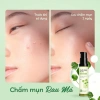Combo Serum và Chấm Mụn Rau Má - Ngừa Mụn Cỏ Mềm, Mờ Vết Thâm, Giá 510k 5