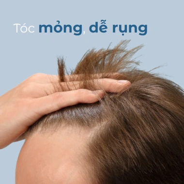 Dầu Gội BC Root Activating 250ml - Giảm Rụng Tóc, Tăng Dày, Giá Ưu Đãi 398.000đ 4