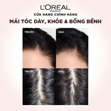 Dầu gội L'Oreal Paris Elseve Resist 440ml - Ngừa rụng, tóc chắc khỏe, giảm 239k 5