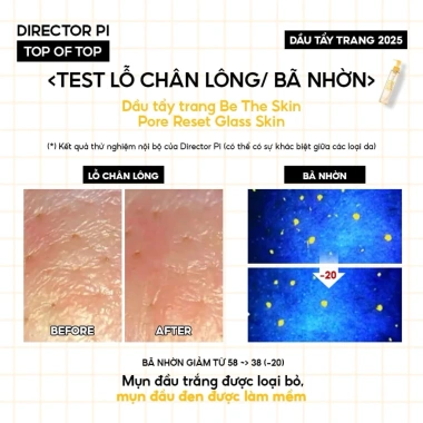 Dầu Tẩy Trang Be The Skin Pore Reset 150ml - Sạch Sâu, Da Mượt Giá 349.000₫ 4 Dầu Tẩy Trang Be The Skin Pore Reset 150ml - Sạch Sâu, Da Mượt Giá 349.000₫ 4