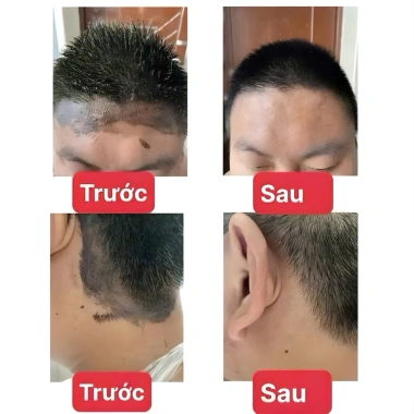 Dung Dịch Lau Màu Nhuộm Tóc 50ml - Dịu nhẹ, không kích ứng, làm sạch màu cứng đầu 9 Dung Dịch Lau Màu Nhuộm Tóc 50ml - Dịu nhẹ, không kích ứng, làm sạch màu cứng đầu 9