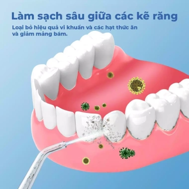 GOKOCO Máy tăm nước 4 đầu phun 150ml - Nhỏ gọn du lịch, thích hợp niềng răng & nướu nhạy cảm, giảm 349.000 3
