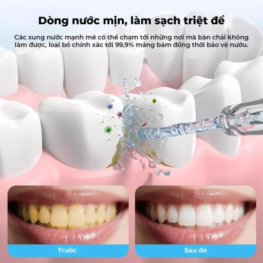 GOKOCO Máy Tăm Nước Cầm Tay IPX7 3 Chế Độ Áp Lực, Sạc Nhanh Type-C, Dùng 30 Ngày - Giá 318.000 VND 4
