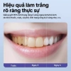 GOKOCO Nha Khoa LED Làm Trắng & Làm Sạch Răng Tại Nhà - Giá Ưu Đãi 299.000đ 6