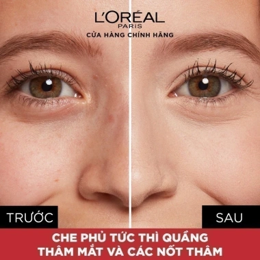 Kem Che Khuyết Điểm L'Oreal Paris Infallible Full Wear 10ml - Độ Che 100%, Không Lo Trôi, Giá 259k