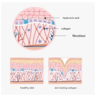 Kem Collagen Pretty Face 90g - Kem chống nhăn Hàn Quốc, tăng độ đàn hồi & độ ẩm, giá chỉ 232.301₫ 4 Kem Collagen Pretty Face 90g - Kem chống nhăn Hàn Quốc, tăng độ đàn hồi & độ ẩm, giá chỉ 232.301₫ 4