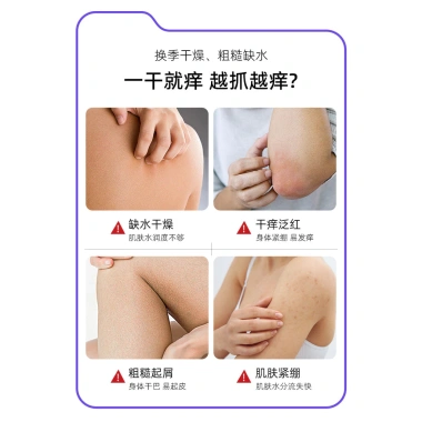 Kem Dưỡng ẩm Lithospermum 350g - Chống Ngứa, Dưỡng ẩm Khô, Giá ưu đãi 118.540 VND