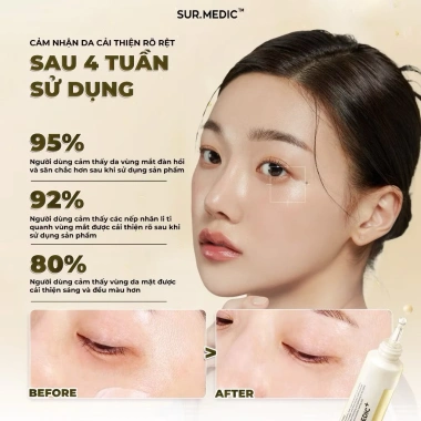 Kem Dưỡng Mắt Sur.Medic+ 35ml Giảm Nếp Nhăn, Ngăn Lão Hóa - Giá 670.000₫, khuyến mãi từ 871.000₫