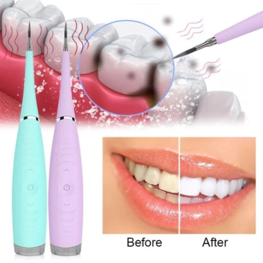 Máy Lấy Cao Răng Tại Nhà Cao Cấp - Dụng Cụ Lấy Cao Răng Giá 158.000 VNĐ 4 Máy Lấy Cao Răng Tại Nhà Cao Cấp - Dụng Cụ Lấy Cao Răng Giá 158.000 VNĐ 4