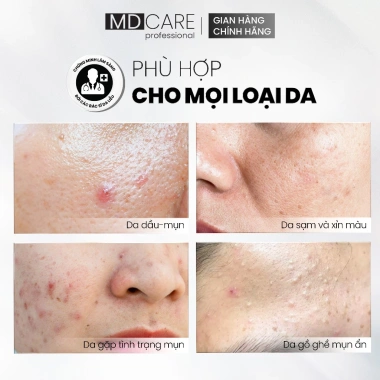 MD CARE AntiAc Exfo 10ml - Tẩy tế bào chết, kiểm soát mụn, giảm viêm, giảm dầu, giá 199.500₫ 5 MD CARE AntiAc Exfo 10ml - Tẩy tế bào chết, kiểm soát mụn, giảm viêm, giảm dầu, giá 199.500₫ 5