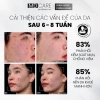 MD CARE AntiAc Exfo 10ml - Tẩy tế bào chết, kiểm soát mụn, giảm viêm, giảm dầu, giá 199.500₫ 6