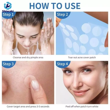 Miếng dán Hydrocolloid dễ bóc – Xóa vết thâm, mụn đầu đen, mụn nhọt tại nhà 3 Miếng dán Hydrocolloid dễ bóc – Xóa vết thâm, mụn đầu đen, mụn nhọt tại nhà 3