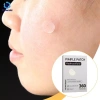 Miếng dán Hydrocolloid dễ bóc – Xóa vết thâm, mụn đầu đen, mụn nhọt tại nhà 5