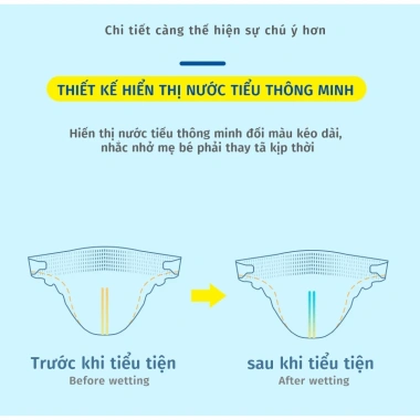 Misecr Tã Dán Trẻ Em Siêu Khô, Mỏng - Miễn Phí Vận Chuyển, Tặng Khăn Ướt - 198.000