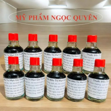 Nước Chấm Mụn 30ml - Giảm mụn, se khít lỗ chân lông, dưỡng da, giá chỉ 55.000đ