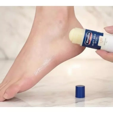 Que đa năng VASELINE VP - Dưỡng ẩm mặt, cơ thể, môi, cổ, gót chân - Balm rắn di động giá ưu đãi 344.161₫