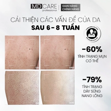Sữa Dưỡng Thể Da Mụn MD CARE Calming Moisturizing 200ml - Giảm Giá Đến 427.500₫