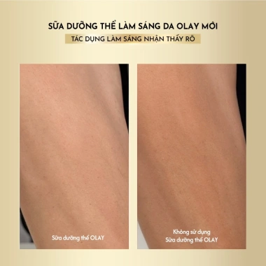 Sữa Dưỡng Thể Olay 5% Niacinamide + Vitamin C 260g - Sáng Da, Hương Nước Hoa, Giá 312k