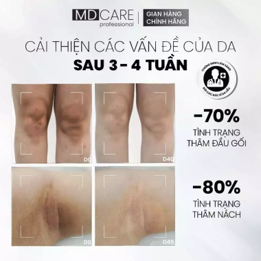 Sữa Dưỡng Thể Sáng Da Mờ Thâm Alpha Arbutin Niacinamide MD CARE 200ml - Giá 532k