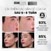 Tẩy Tế Bào Chết MD CARE AntiAc Exfo 30ml Kiểm Soát Mụn Giảm Viêm Giảm Dầu Giá 199k 6