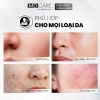 Tẩy Tế Bào Chết MD Care Mande Exfo 10ml - Sáng Da, Cấp Ẩm, Căng Bóng 171k 5