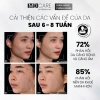 Tẩy Tế Bào Chết MD Care Mande Exfo 10ml - Sáng Da, Cấp Ẩm, Căng Bóng 171k 6