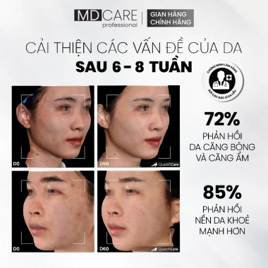 Tẩy Tế Bào Chết MD Care Mande Exfo 10ml - Sáng Da, Cấp Ẩm, Căng Bóng 171k 6 Tẩy Tế Bào Chết MD Care Mande Exfo 10ml - Sáng Da, Cấp Ẩm, Căng Bóng 171k 6