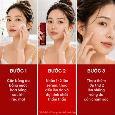 Tinh chất 17Hours Red Spot serum Aczero 4‑Terpeneol + Tea Tree Oil, làm dịu da, giảm vết đỏ 30ml - 435.500₫
