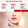 Tinh chất 17Hours Red Spot serum Aczero 4‑Terpeneol + Tea Tree Oil, làm dịu da, giảm vết đỏ 30ml - 435.500₫ 8