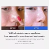Toner Pad MEDICUBE ZERO PORE PAD 2.0 Red Succinic Acid 155g Se khít lỗ chân lông, Giá chỉ 325k 3