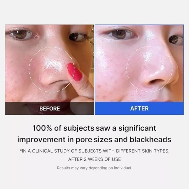 Toner Pad MEDICUBE ZERO PORE PAD 2.0 Red Succinic Acid 155g Se khít lỗ chân lông, Giá chỉ 325k 3