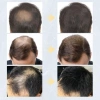 Toppik 27,5g Bột Sợi Tóc Đen Keratin Tự Nhiên Không Kích Ứng Giao Nhanh Giá 85.800đ 4
