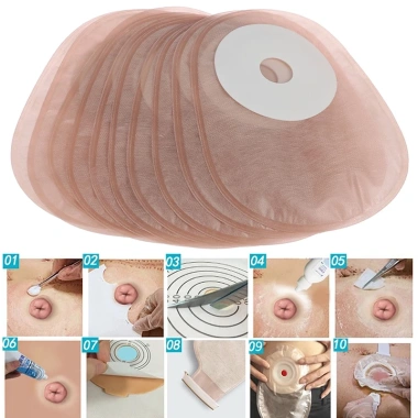 Túi Colostomy 12h FAS 1/10 25-60mm Một Mảnh Mở Kẹp – Giá 72,160₫ (Giảm 20%) VN 8