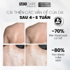 Xịt Tẩy Tế Bào Chết Toàn Thân AHAs BHA MD CARE 100ml Da Mịn Mờ Đốm Giá 342k 5